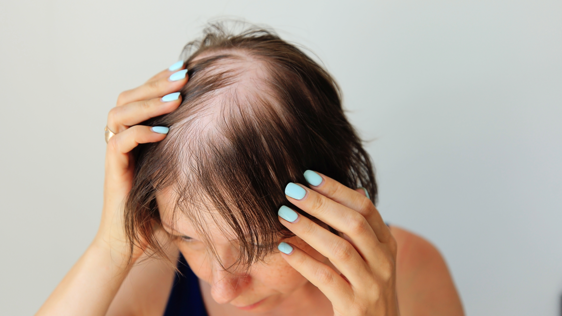 Advanced alopecia therapies for men and women at Gold Skin Care Center Nashville